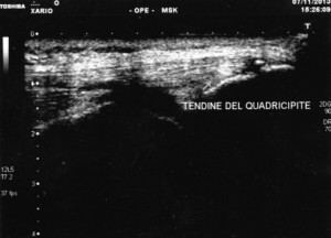 Ecografia Muscolo–Scheletrica o Muscolo-Tendinea 2 Ecografia Muscolo–Scheletrica o Muscolo-Tendinea nomentano