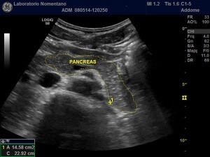 Ecografia del Pancreas o Pancreatica 2 ecografia pancreas pancreatica laboratorio nomentano monterotondo