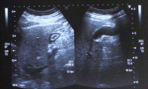 ecografia addome completo monterotondo