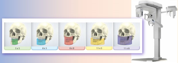 Radiologia Dentale in 3D 1 radiologia dentale nomentano monterotondo