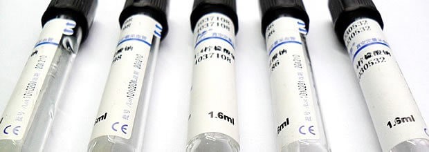 Visita Ematologica ed Ematologia nomentano