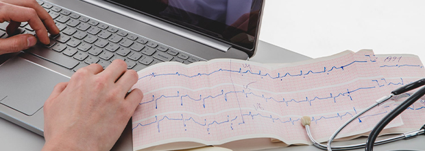 ecocardiogramma e elettrocardiogramma nomentano roma ecocardiogramma e elettrocardiogramma nomentano roma