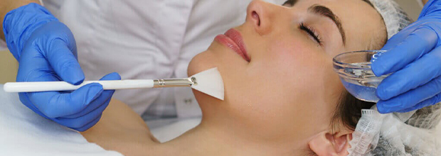 peeling del viso nomentano roma