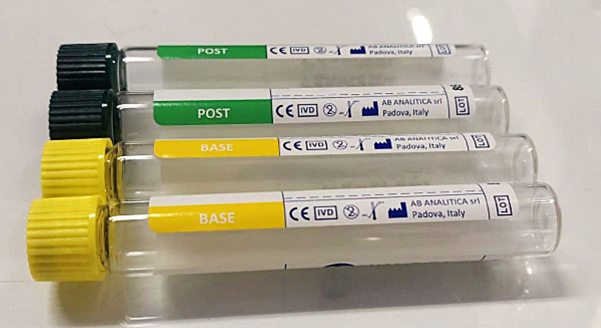 breath test lattulosio